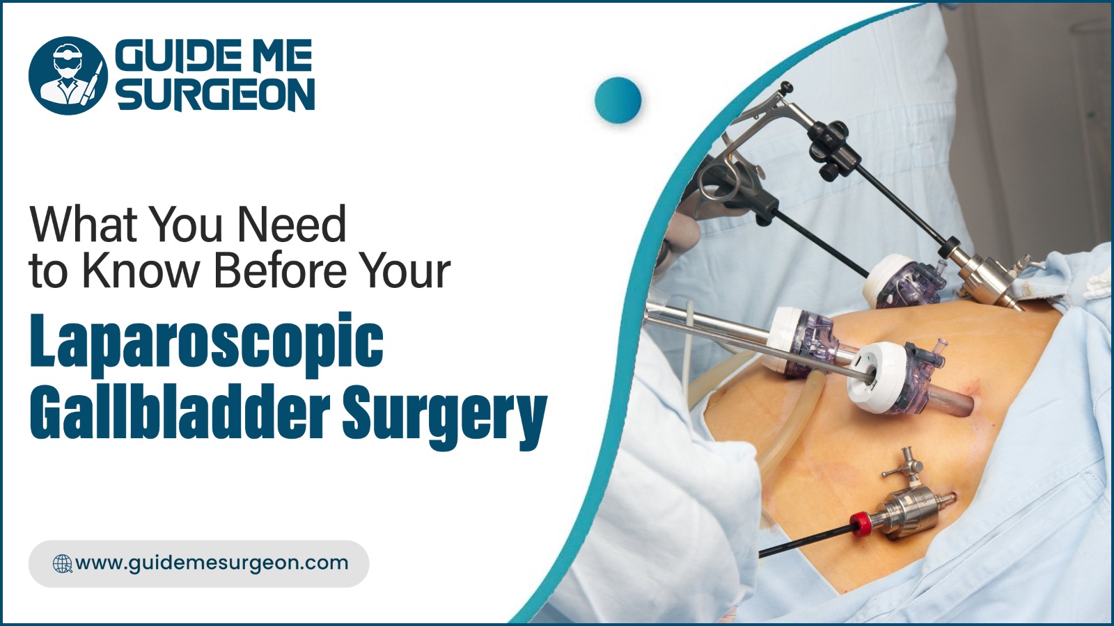 What You Need to Know Before Your Laparoscopic Gallbladder Surgery
