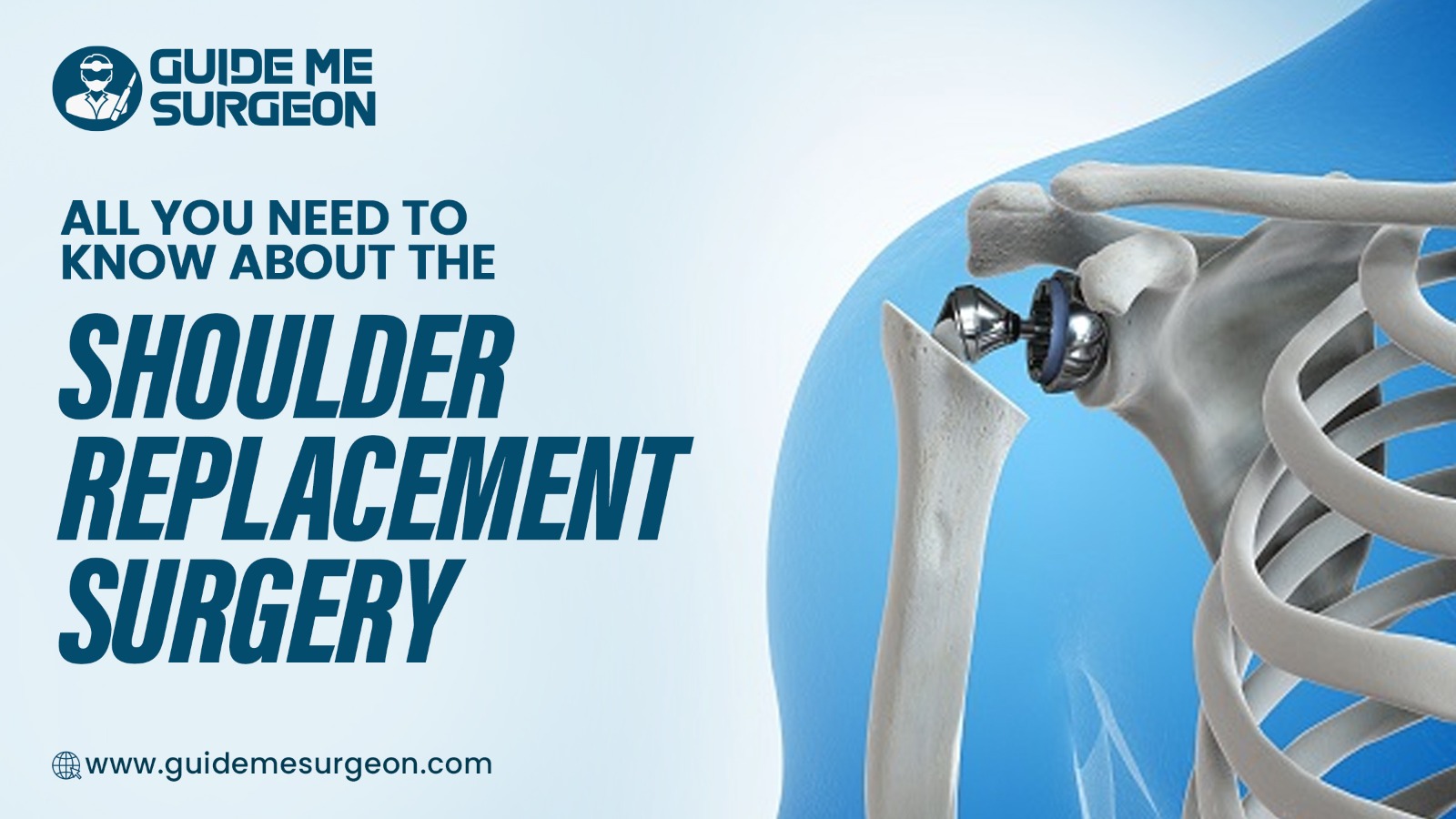 All You Need to Know About the Shoulder Replacement Surgery
