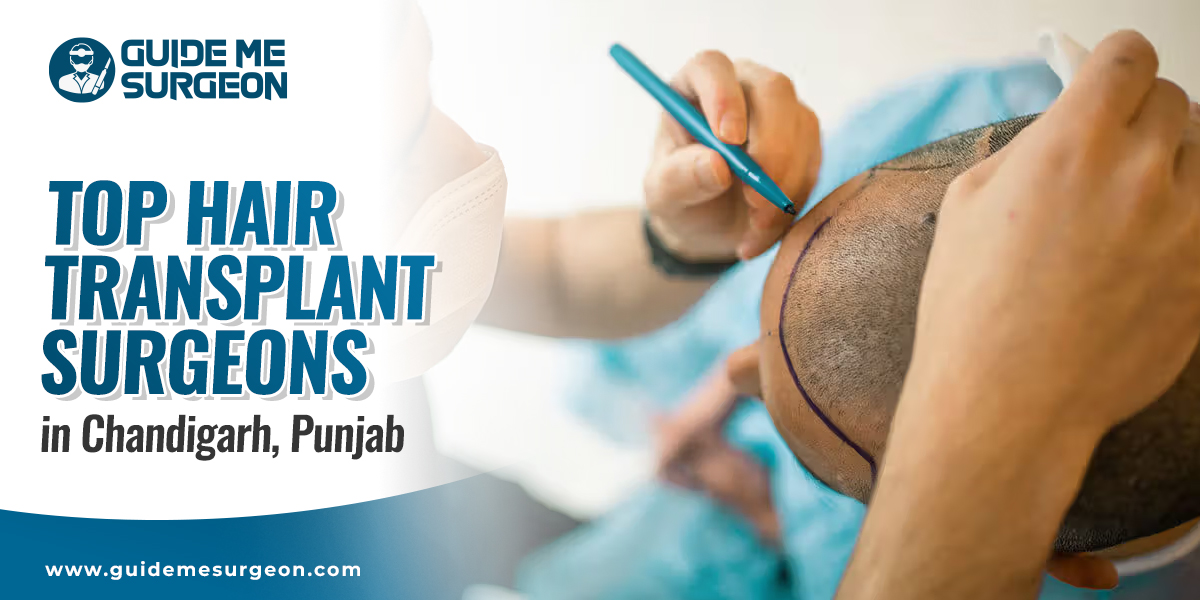 Top Hair Transplant Surgeons in Chandigarh with FUE and FUT Treatments
